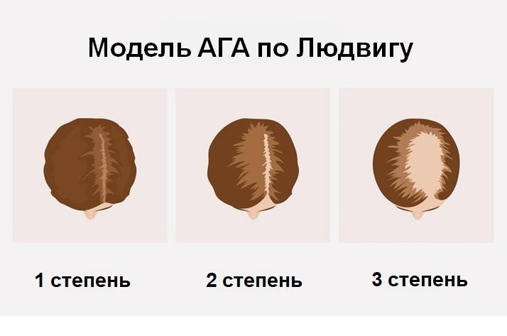 модель ага по Людвигу