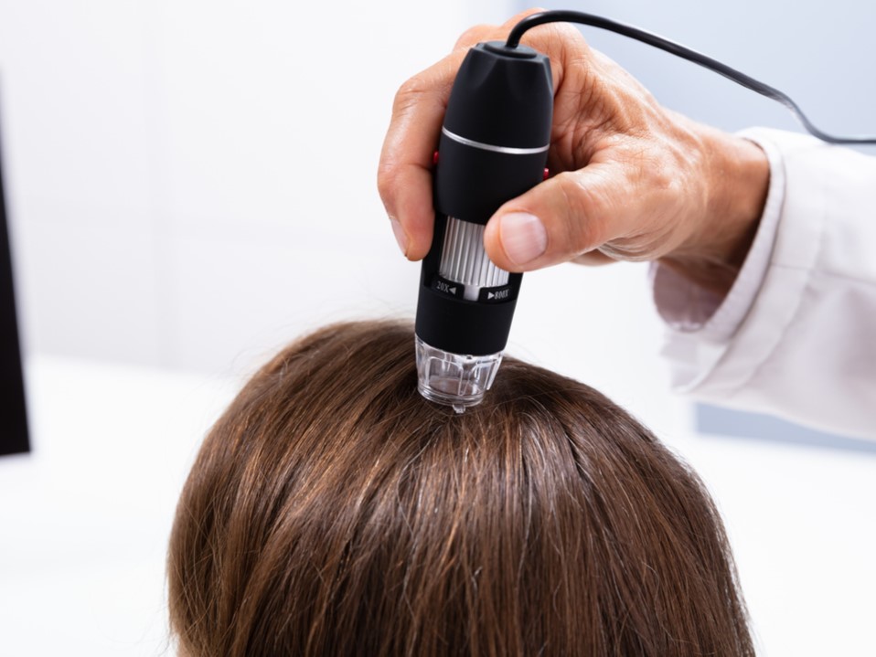 трихоскопия