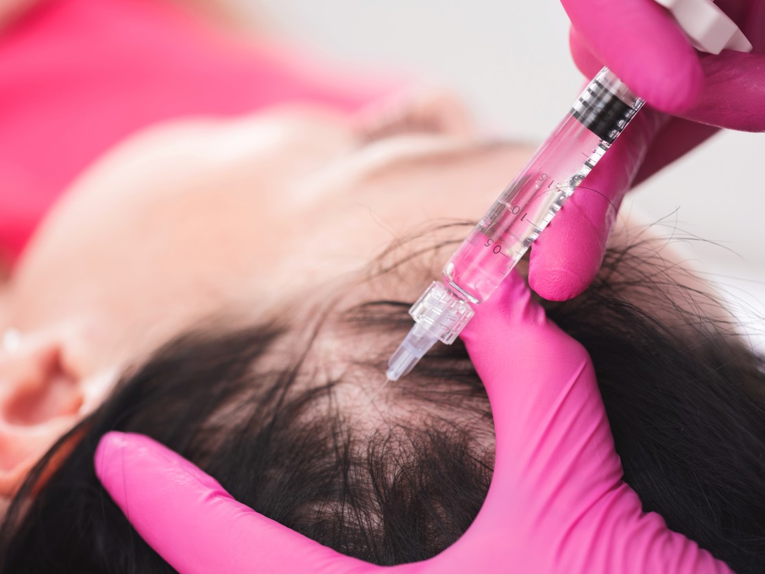 озонотерапия