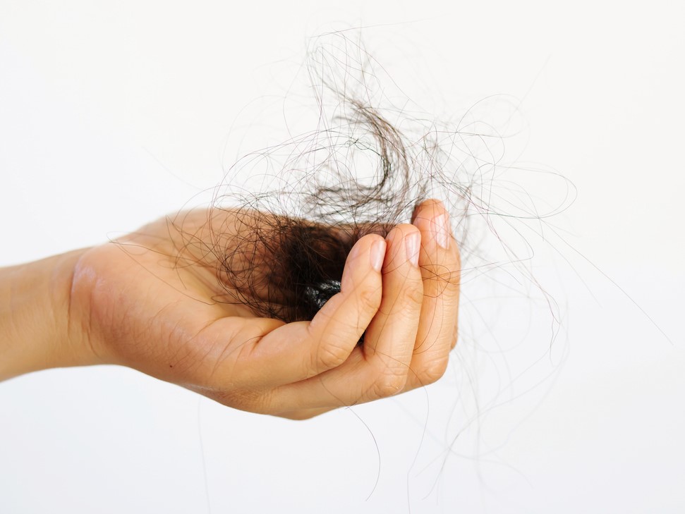 ошибки при выпадении волос