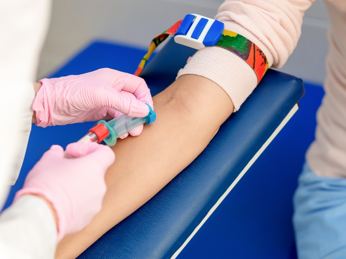 сбой гормонов и выпадение волос