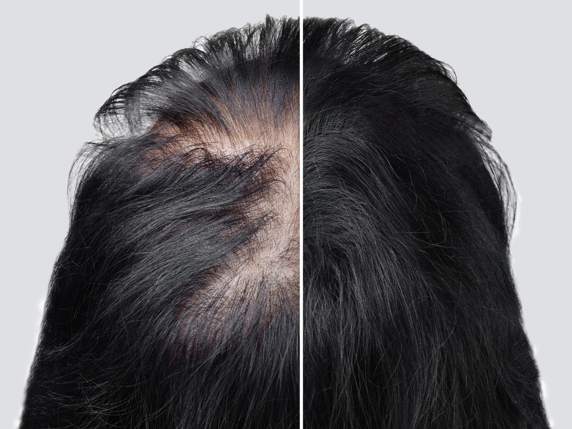 топпик для головы и волос