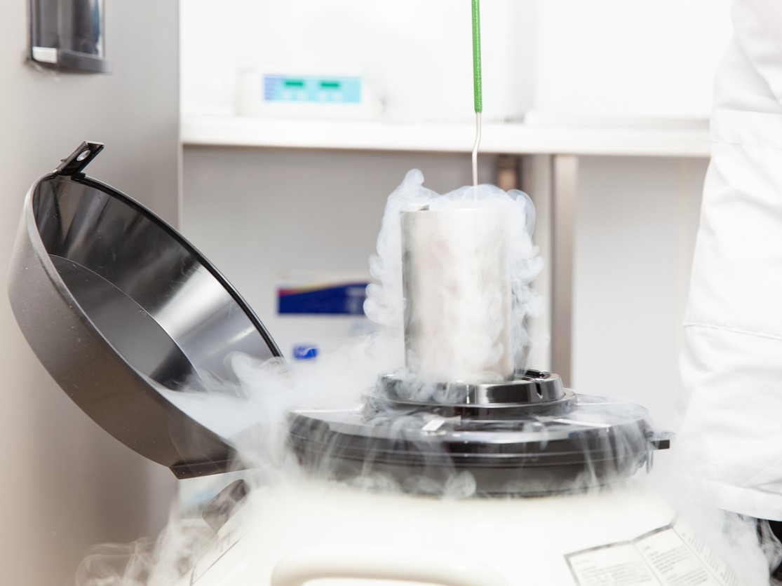 криотерапия при выпадении волос