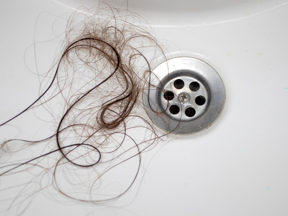 влияние стресса на выпадение волос