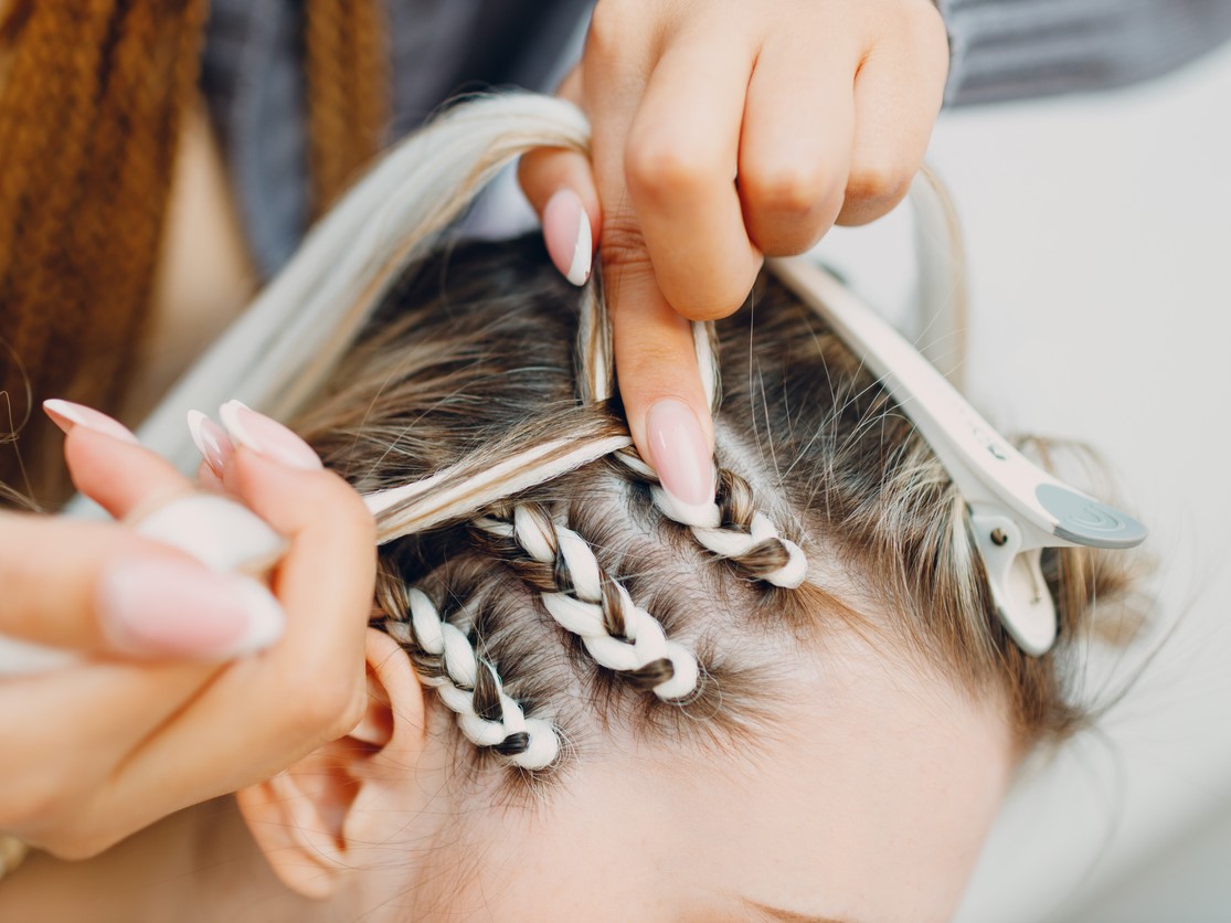 тракционная алопеция