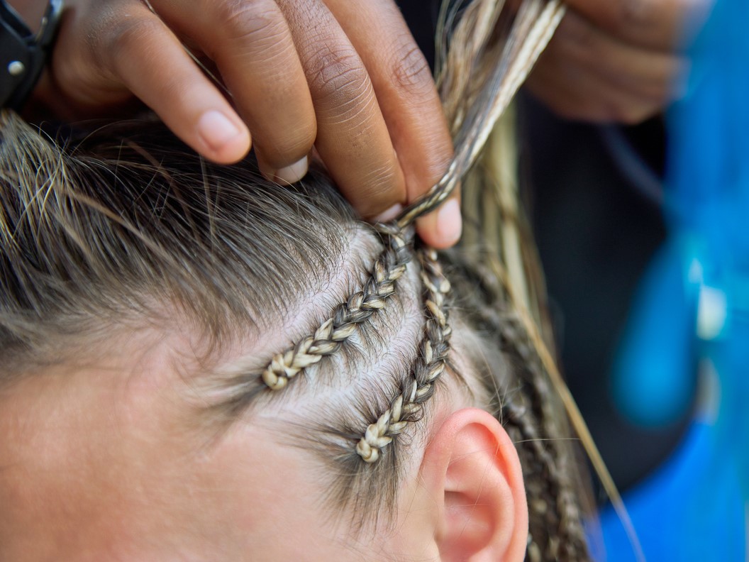 тракционная алопеция