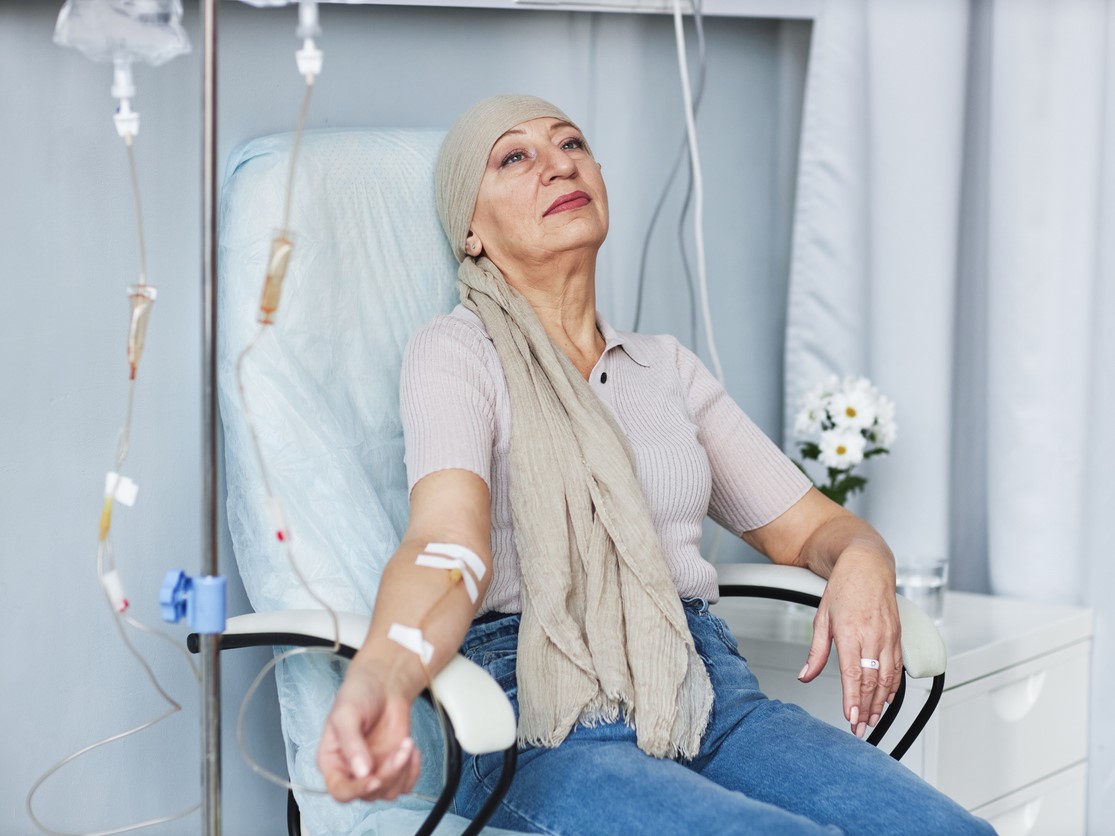 Выпадение волос после химиотерапии