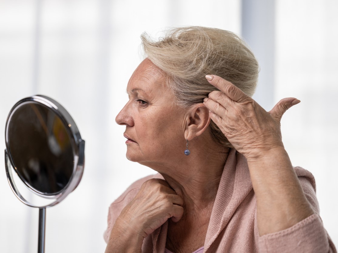 Алопеция при менопаузе