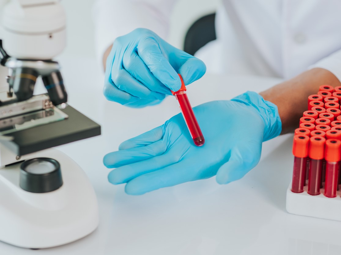 анализы при выпадении волос