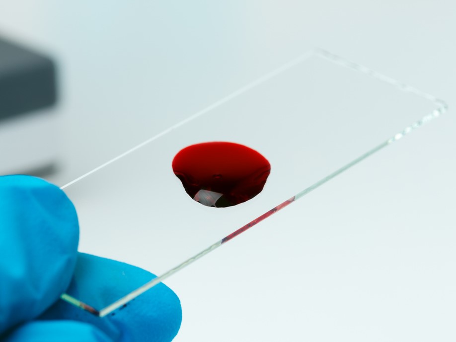 анализы для волос при выпадении