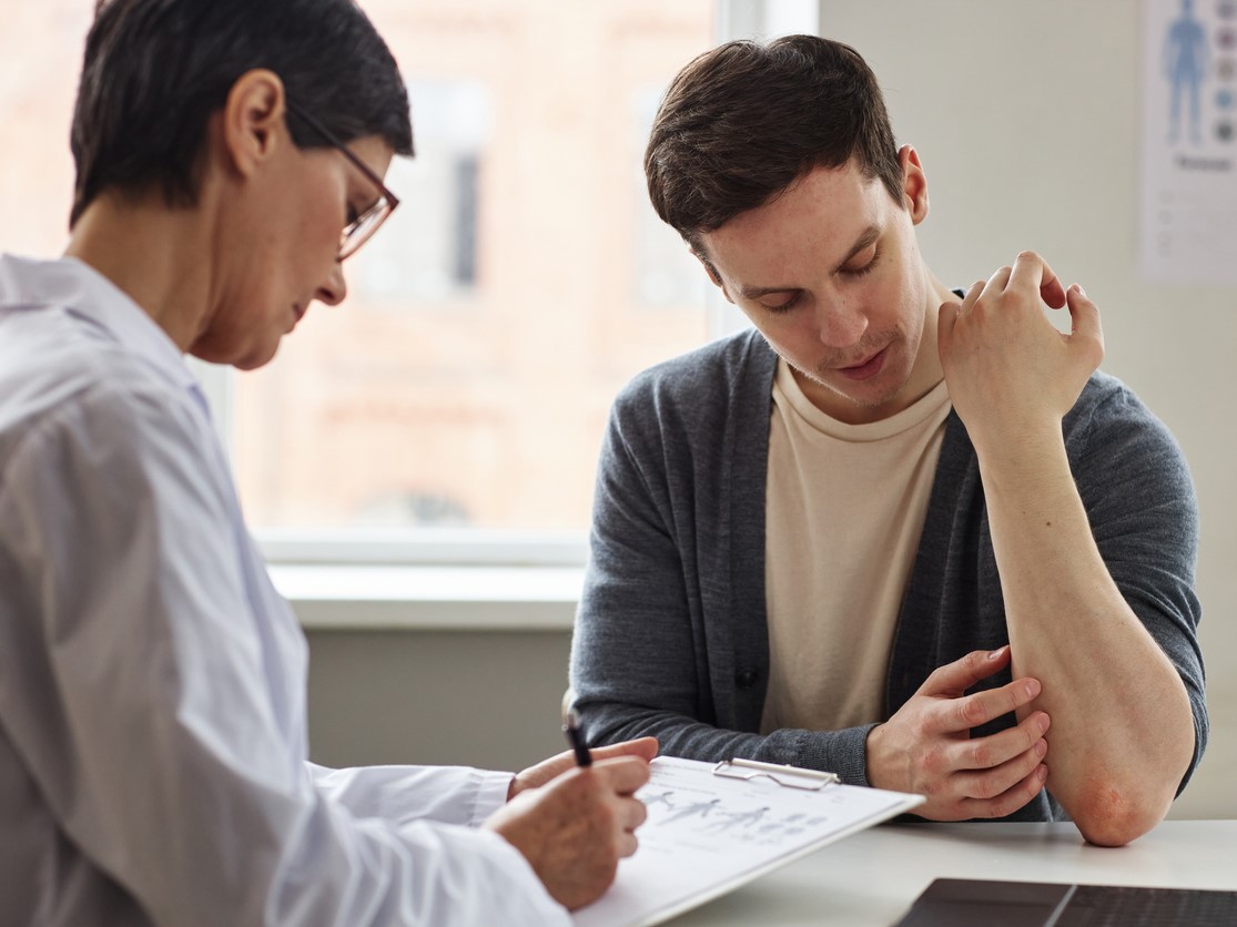 лечение псориаза