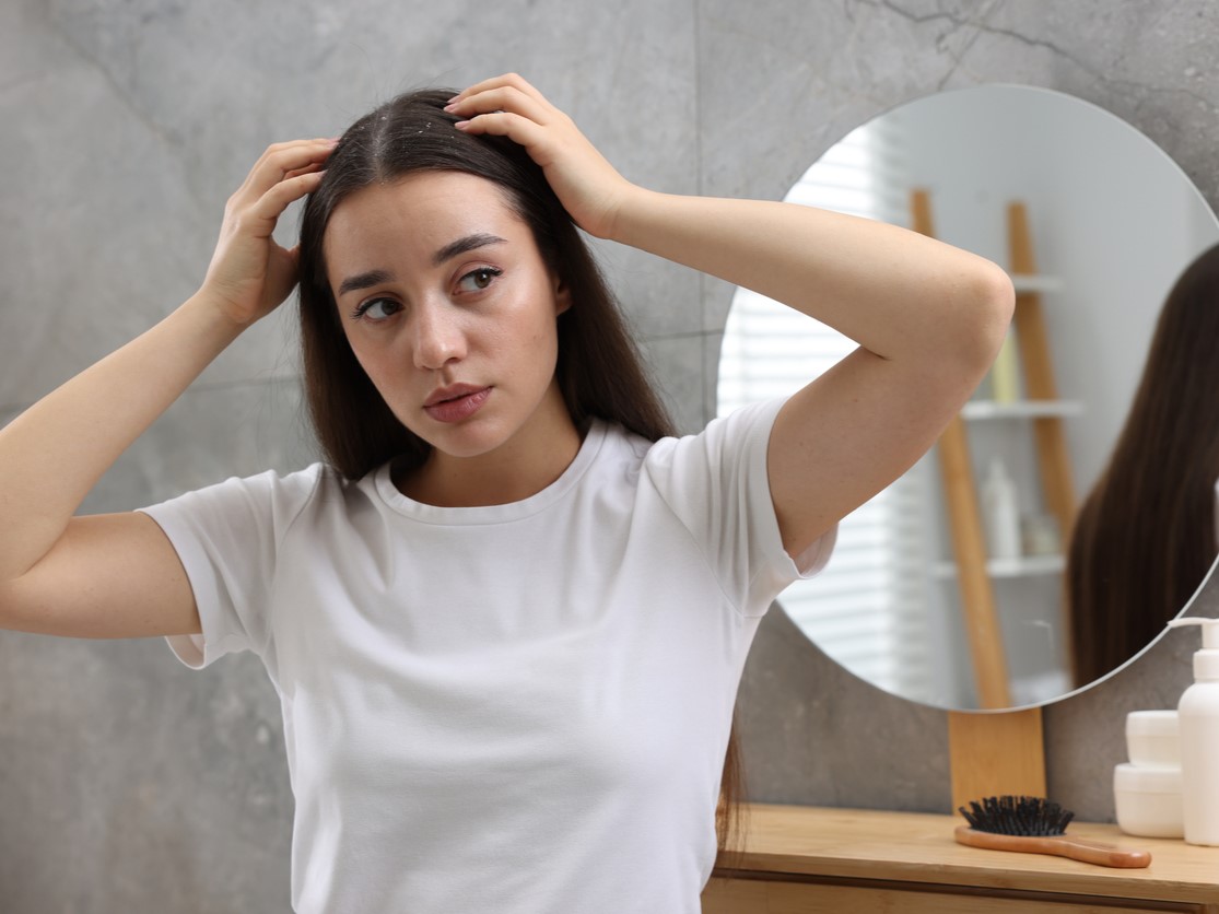 что делать при себорее