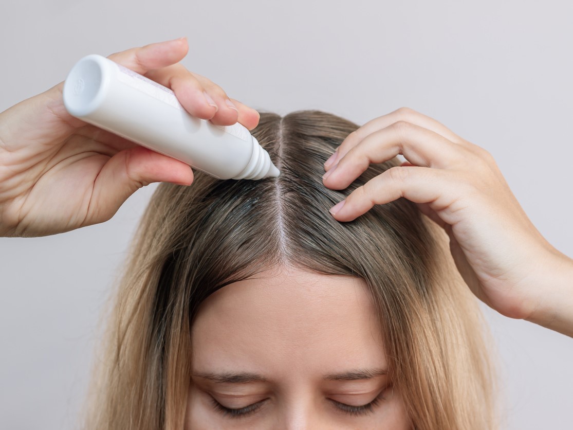 SPRAYE, TONIKI, LOTIONY przeciw wypadaniu włosów, do odżywiania i aktywacji uśpionych mieszków włosowych