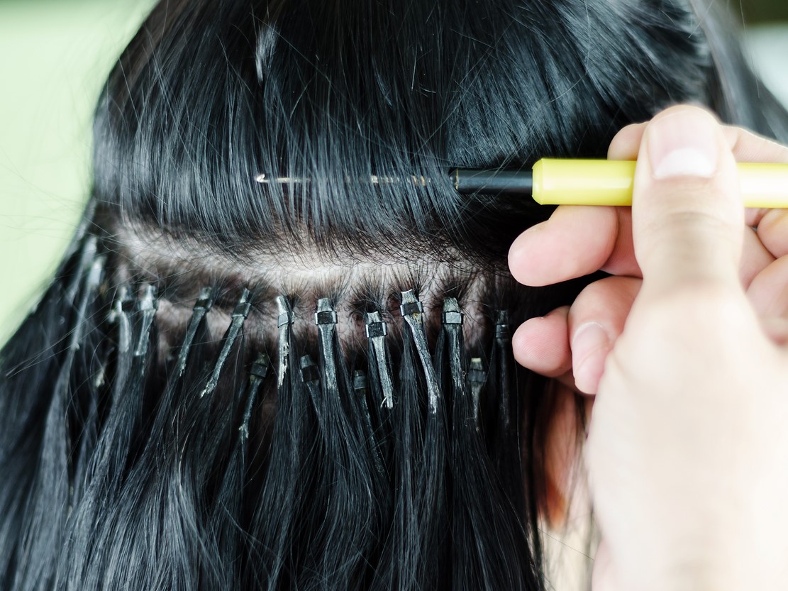 Тракционная алопеция