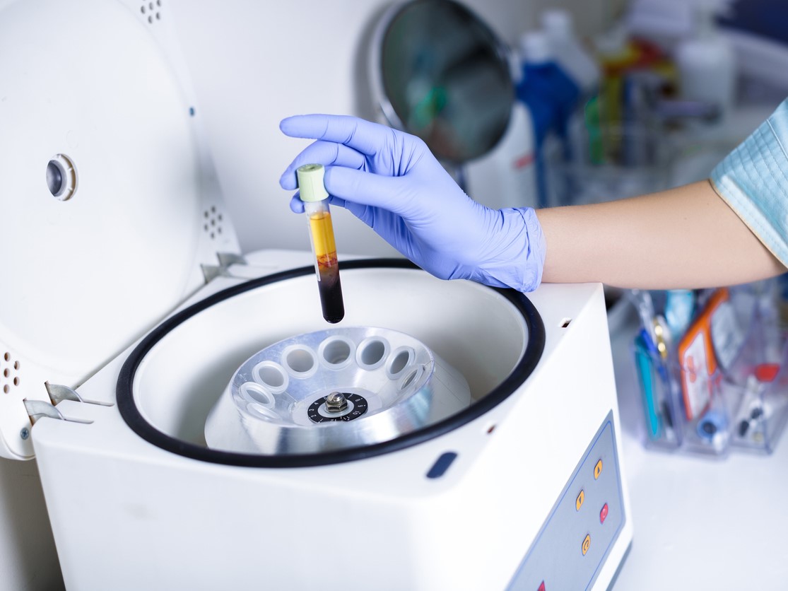 плазмолифтинг