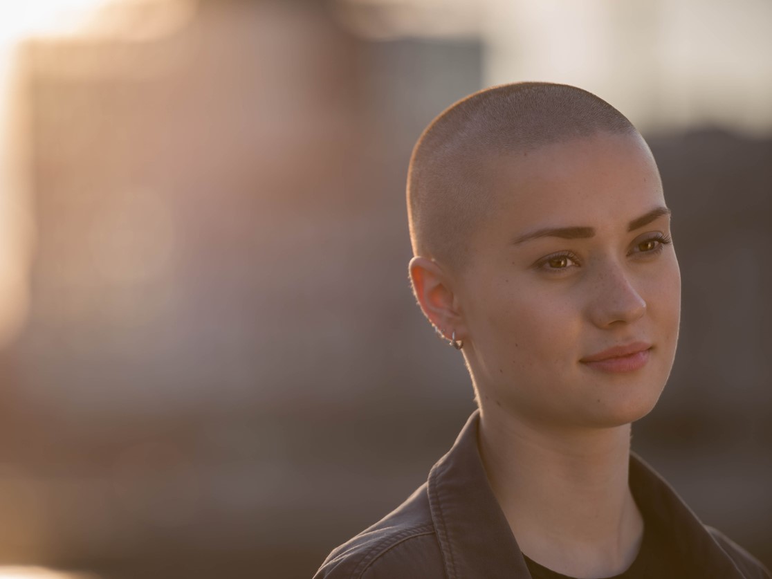 очаговая алопеция, гнездная алопеция, ареата