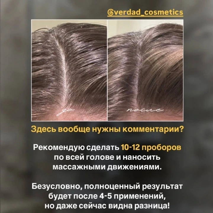 Пилинг-маска для очищения кожи головы и активации роста новых волос, Verdad