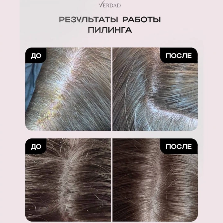 Пилинг-маска для очищения кожи головы и активации роста новых волос, Verdad