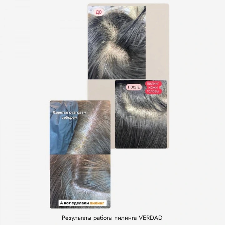 Пилинг-маска для очищения кожи головы и активации роста новых волос, Verdad