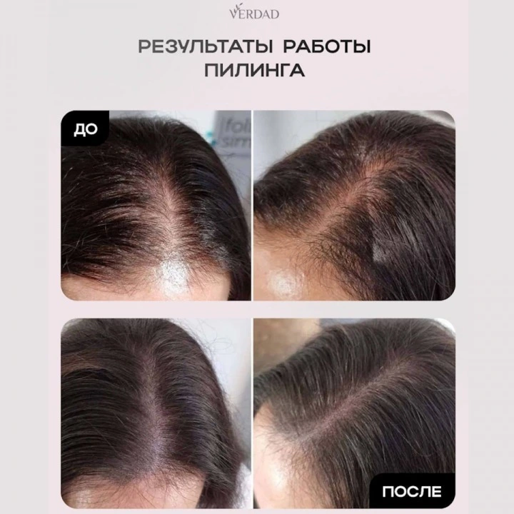 Пилинг-маска для очищения кожи головы и активации роста новых волос, Verdad