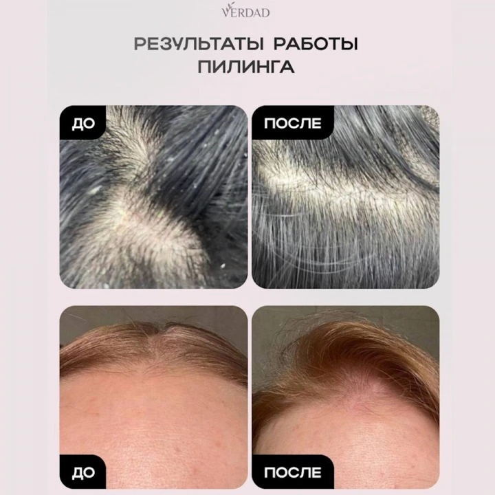 Пилинг-маска для очищения кожи головы и активации роста новых волос, Verdad