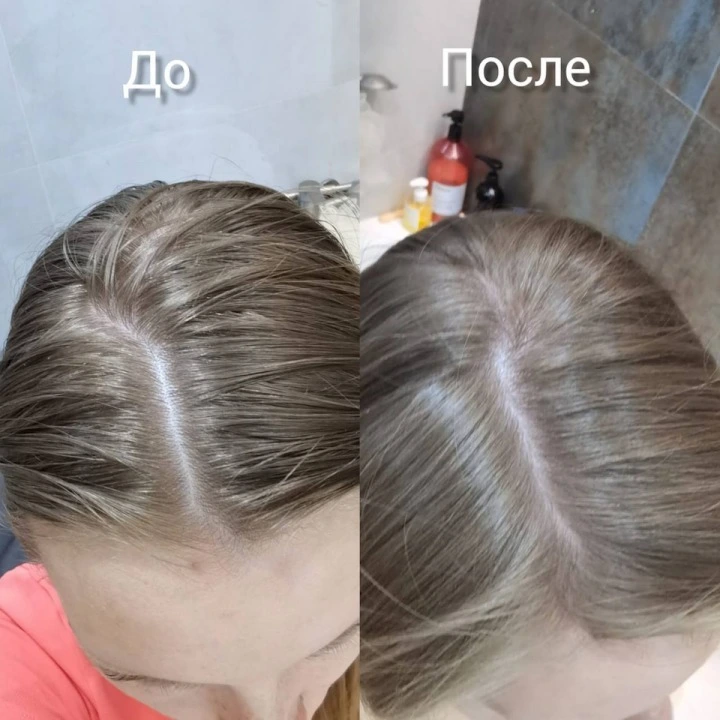 Пилинг-маска для очищения кожи головы и активации роста новых волос, Verdad