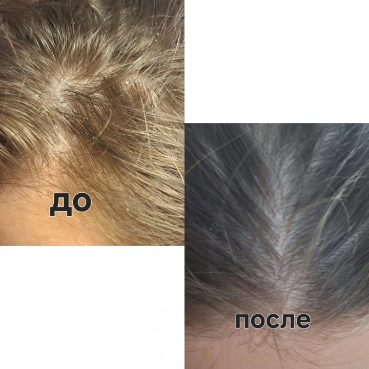 Пилинг-маска для очищения кожи головы и активации роста новых волос, Verdad