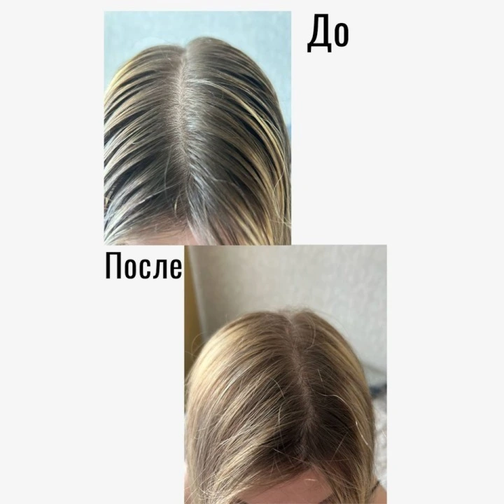 Пилинг-маска для очищения кожи головы и активации роста новых волос, Verdad