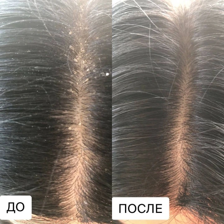 Пилинг-маска для очищения кожи головы и активации роста новых волос, Verdad