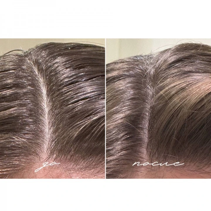 Пилинг-маска для очищения кожи головы и активации роста новых волос, Verdad