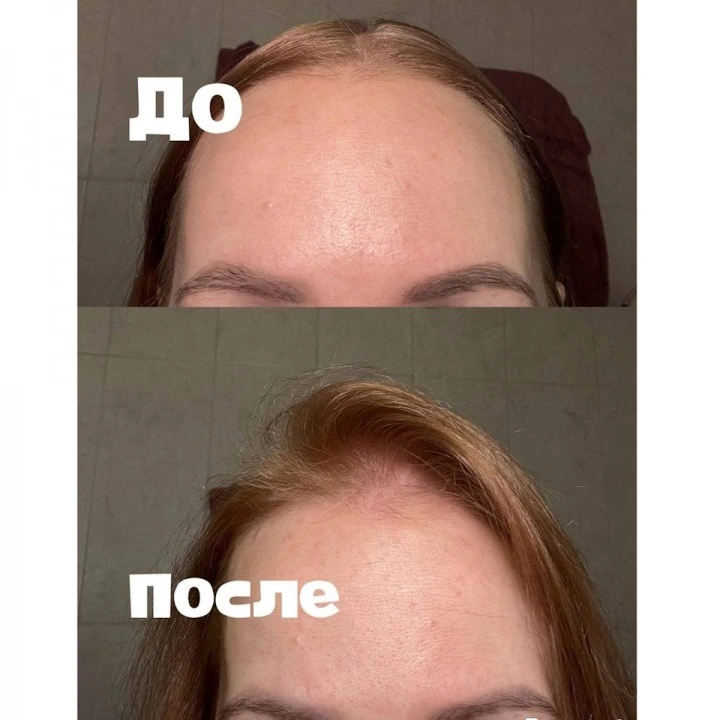 Пилинг-маска для очищения кожи головы и активации роста новых волос, Verdad