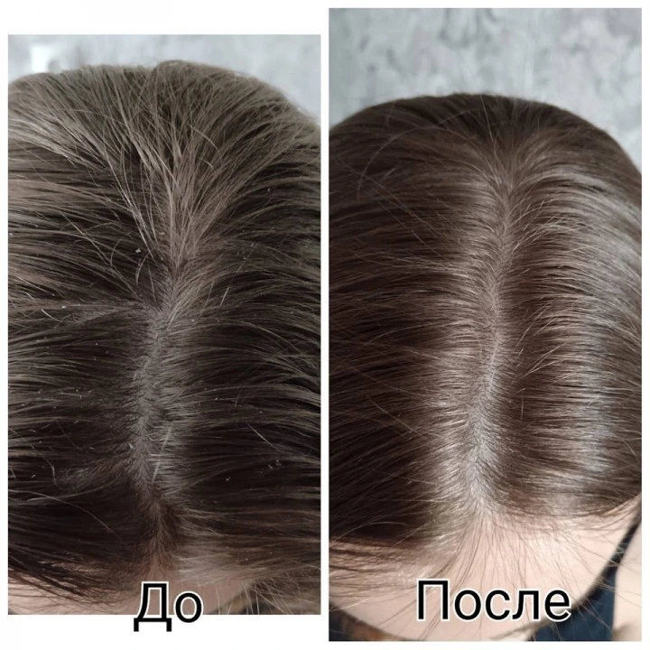 Пилинг-маска для очищения кожи головы и активации роста новых волос, Verdad