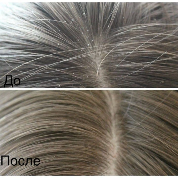 Пилинг-маска для очищения кожи головы и активации роста новых волос, Verdad
