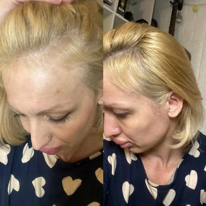 Пептидная сыворотка от выпадения волос, АГА с розмарином и минералами, Verdad