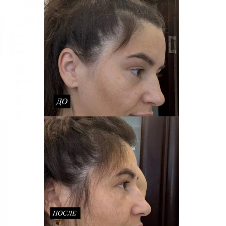 Пептидная сыворотка от выпадения волос, АГА с розмарином и минералами, Verdad