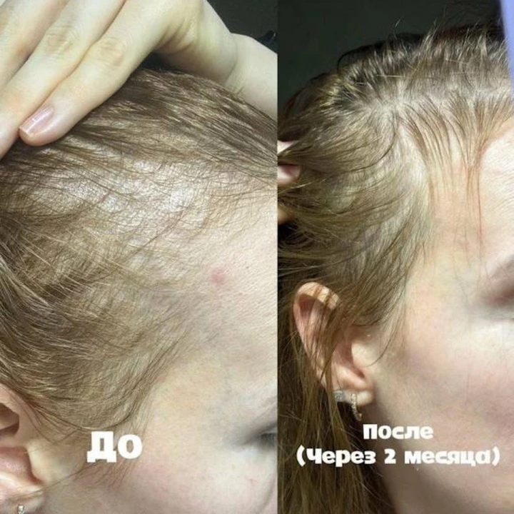 Пептидная сыворотка от выпадения волос, АГА с розмарином и минералами, Verdad