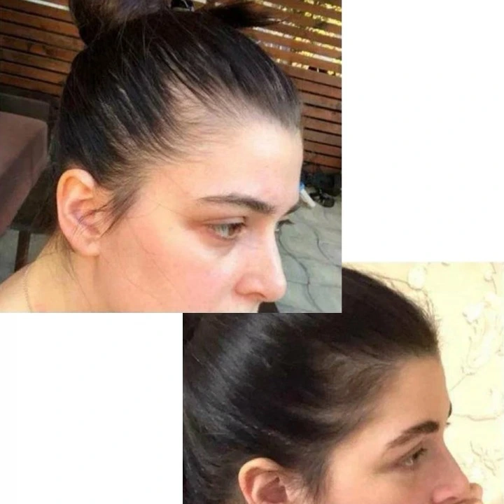 Пептидная сыворотка от выпадения волос, АГА с розмарином и минералами, Verdad