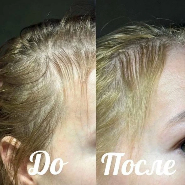 Пептидная сыворотка от выпадения волос, АГА с розмарином и минералами, Verdad