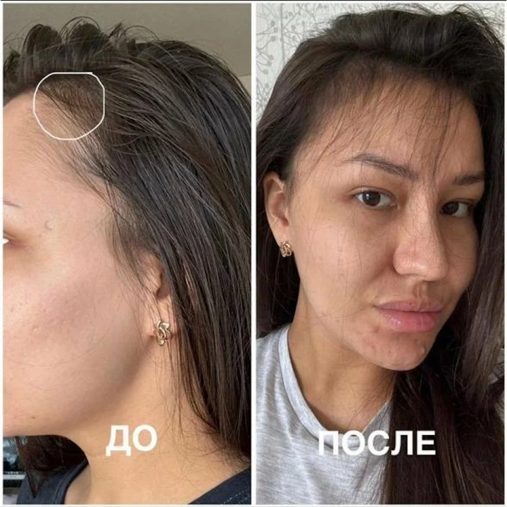 Сыворотка-концентрат от выпадения с Capixyl, розмарином, цинком, медью, Verdad