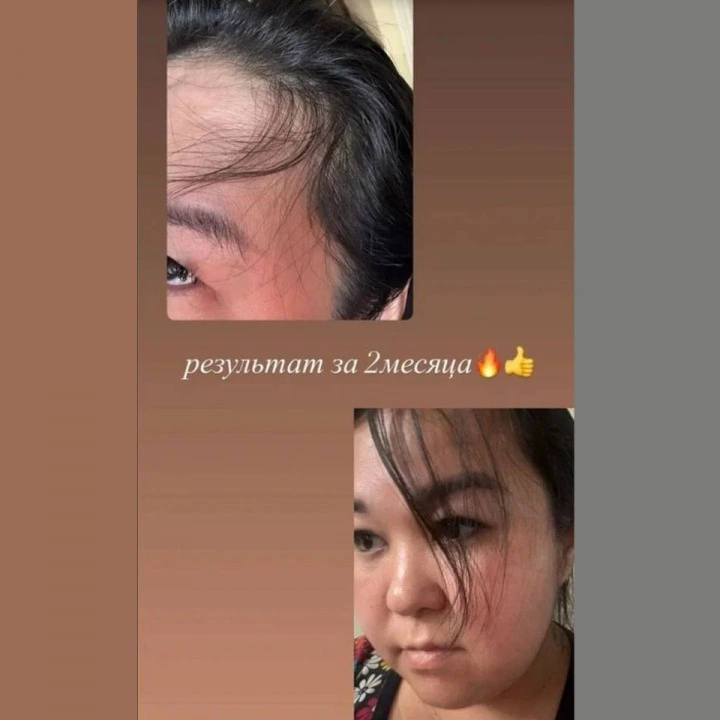 Сыворотка-концентрат от выпадения с Capixyl, розмарином, цинком, медью, Verdad