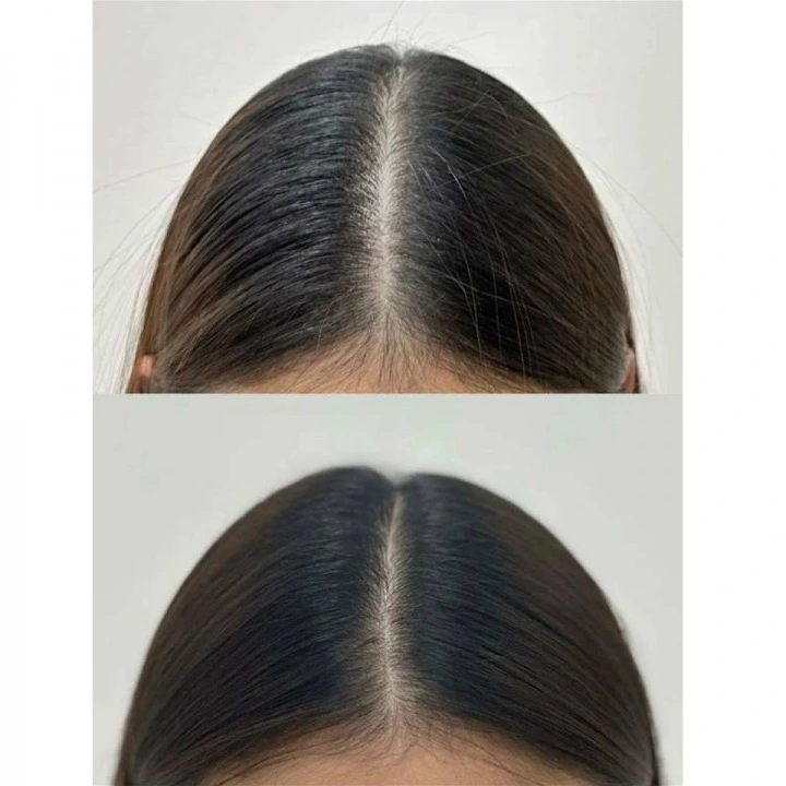 Сыворотка-концентрат от выпадения с Capixyl, розмарином, цинком, медью, Verdad