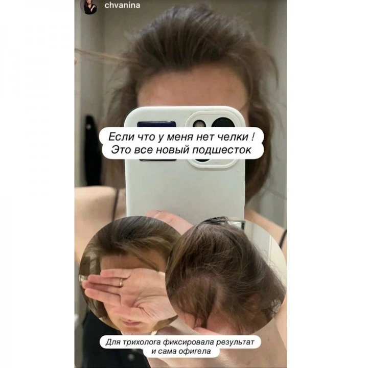 Сыворотка-концентрат от выпадения с Capixyl, розмарином, цинком, медью, Verdad