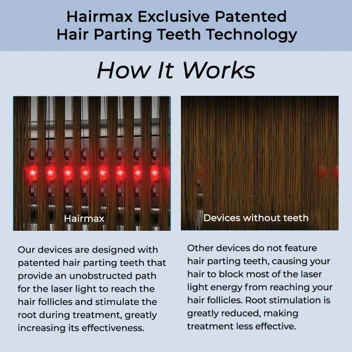 Oryginalna laserowa opaska przeciw wypadaniu włosów i AGA LaserBand 41, HairMax