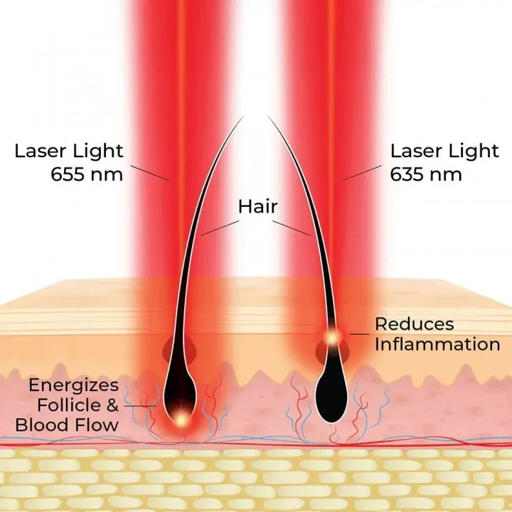 Oryginalna laserowa szczotka do wzrostu włosów Actonis 18 Dual Action LaserComb, HairMax