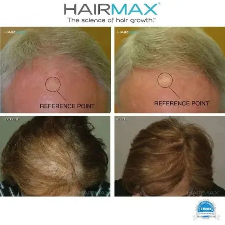 Oryginalna laserowa czapka do stymulacji wzrostu włosów Laser272 PowerFlex Cap, HairMax