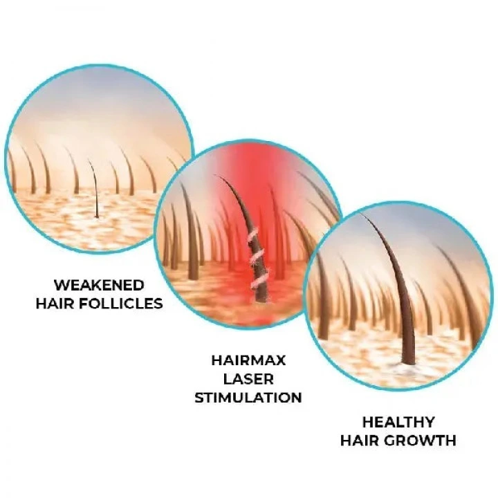 Oryginalna laserowa czapka do stymulacji wzrostu włosów Laser272 PowerFlex Cap, HairMax