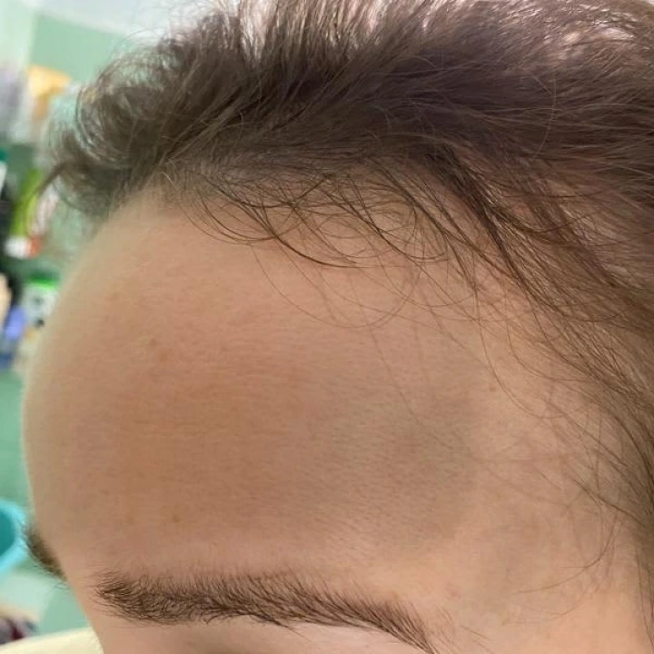 Serum na przerzedzenie i AGA, cynk, biotyna, rozmaryn, kofeina, palma sabalowa, pieprz, Pura Dor