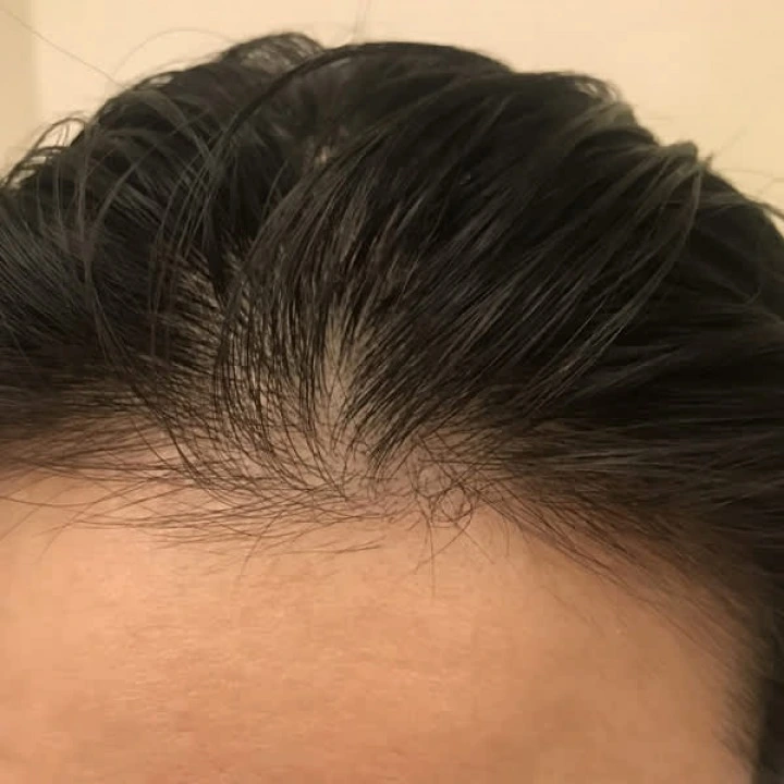 Serum na przerzedzenie i AGA, cynk, biotyna, rozmaryn, kofeina, palma sabalowa, pieprz, Pura Dor