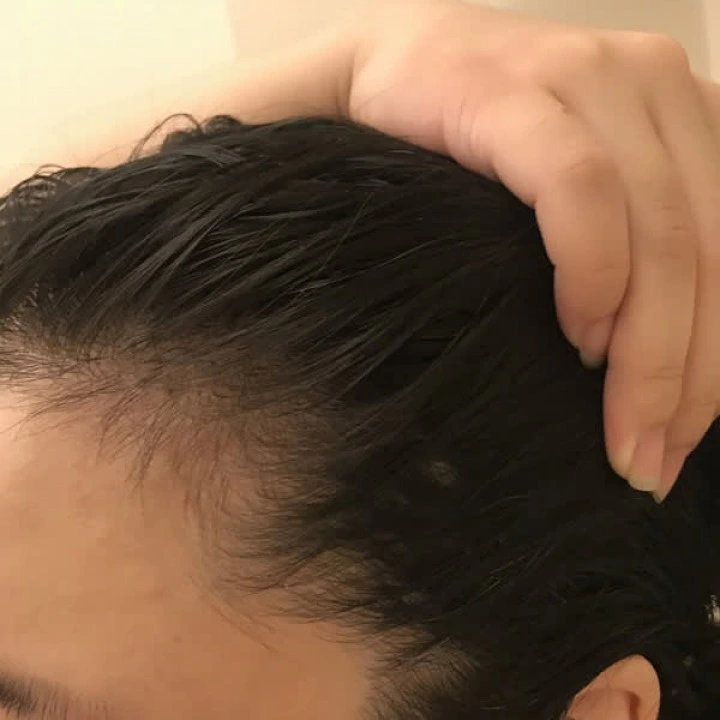 Serum na przerzedzenie i AGA, cynk, biotyna, rozmaryn, kofeina, palma sabalowa, pieprz, Pura Dor