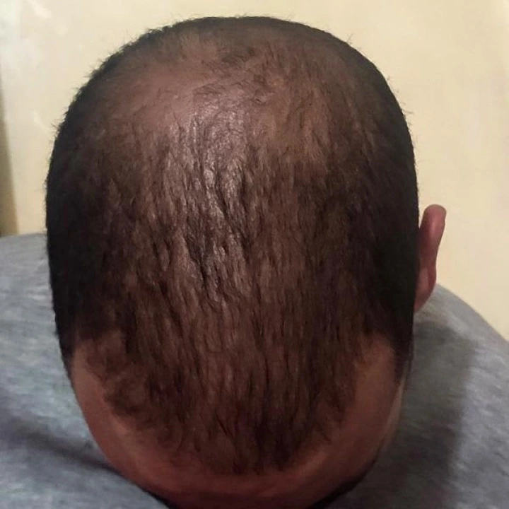 Кондиционер антивозрастной от выпадения со стволовыми клетками, Andalou Naturals